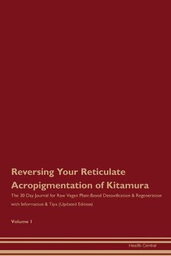 Reversing Your Reticulate Acropigmentation of Kitamura