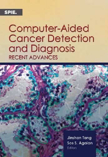 Computer-Aided Cancer Detection and Diagnosis: Recent Advances(Press Monographs)