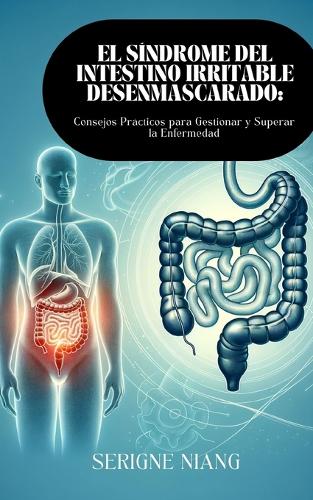 Síndrome del Intestino Irritable Desenmascarado: Consejos Prácticos para Gestionar y Superar la Enfermedad