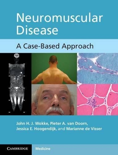 Neuromuscular Disease: A Case-Based Approach
