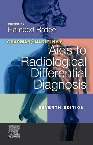 Chapman & Nakielny's AIDS to Radiological Differential Diagnosis