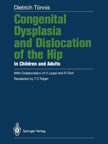 Congenital Dysplasia and Dislocation of the Hip in Children and Adults