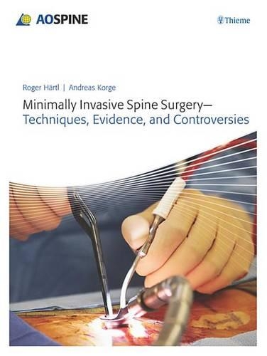 Minimally Invasive Spine Surgery
