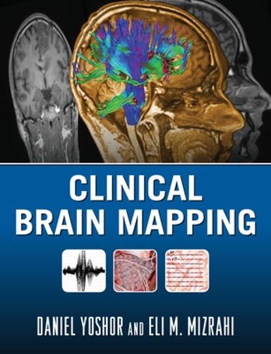 Clinical Brain Mapping
