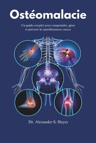 Ostéomalacie