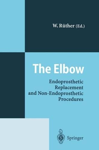 Elbow: Endoprosthetic Replacement and Non-Endoprosthetic Procedures(English)