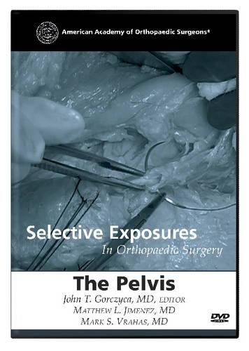 Selective Exposures in Orthopaedic Surgery