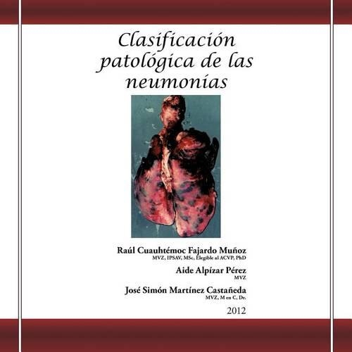 Clasificación patológica de las neumonías: (Spanish)