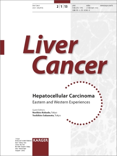 Hepatocellular Carcinoma