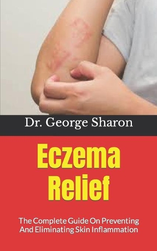 Eczema Relief: The Complete Guide On Preventing And Eliminating Skin Inflammation