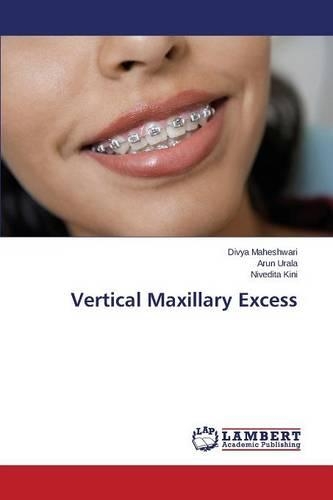 Vertical Maxillary Excess