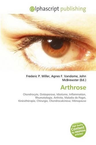 Arthrose: (French)