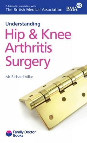 Understanding Hip & Knee Arthritis Surgery