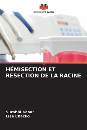 Hémisection Et Résection de la Racine