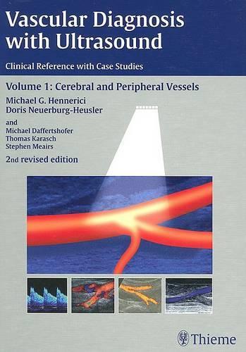 Vascular Diagnosis with Ultrasound