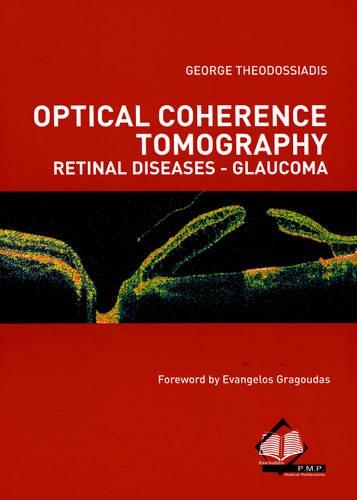 Optical Coherence Tomography Retinal Diseases - Glaucoma
