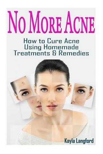 No More Acne