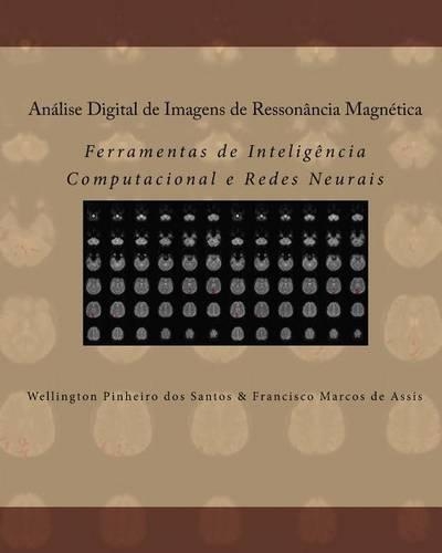 Análise Digital de Imagens de Ressonância Magnética