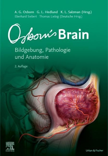 Osborn's Brain: Bildgebung, Pathologie Und Anatomie(Monographie - Fachbuch - Urban & Fischer-Verlag)