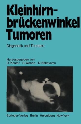 Kleinhirnbruckenwinkel-Tumoren