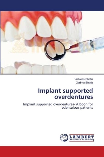 Implant supported overdentures: (English)