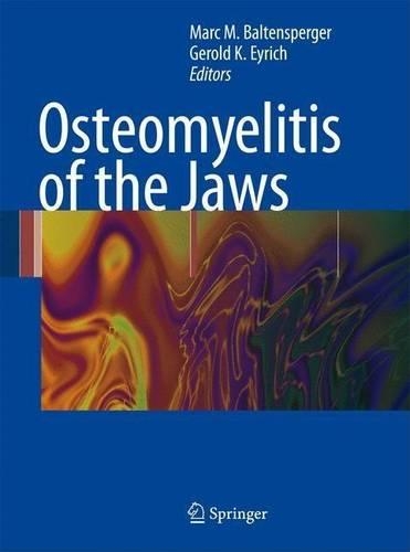 Osteomyelitis of the Jaws