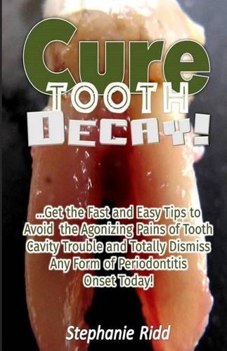 Cure Tooth Decay!: Get the Fast and Easy Tips to Avoid the Agonizing Pains of Tooth Cavity Trouble and Totally Dismiss Any Form of Periodontitis Onset Today!(English)