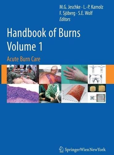 Handbook of Burns Volume 1