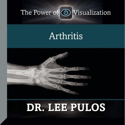 Arthritis