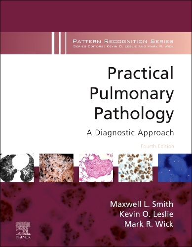 Practical Pulmonary Pathology: A Diagnostic Approach, E-Book: A Volume in the Pattern Recognition Series(Pattern Recognition)