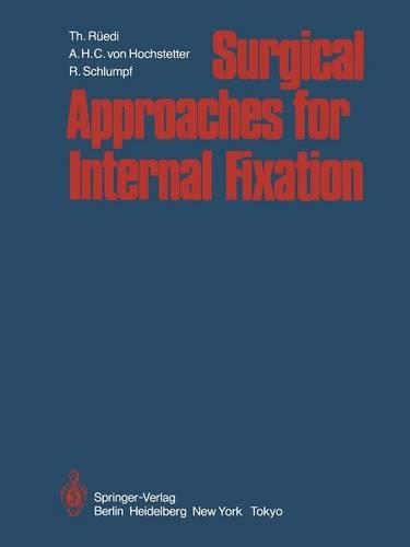 Surgical Approaches for Internal Fixation