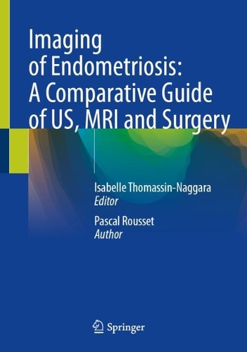 Imaging of Endometriosis: A Comparative Guide of US, MRI and Surgery