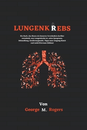 Lungenkrebs: Ein Buch, das Ihnen ein besseres Verständnis darüber vermittelt, was Lungenkrebs ist, seine Symptome, Behandlung, Ernährungswahl, Tipps zum Umgang d