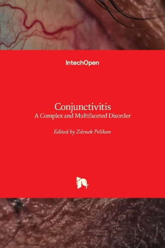 Conjunctivitis