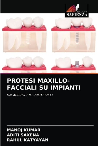 Protesi Maxillo-Facciali Su Impianti