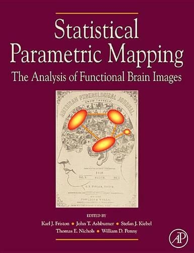 Statistical Parametric Mapping: The Analysis of Functional Brain Images: The Analysis of Functional Brain Images