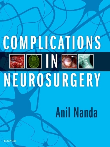 Complications in Neurosurgery E-Book