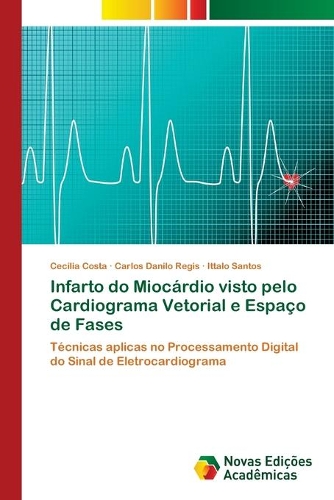 Infarto do Miocárdio visto pelo Cardiograma Vetorial e Espaço de Fases