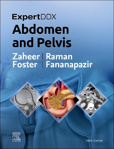 Expertddx: Abdomen and Pelvis E-Book: Expertddx: Abdomen and Pelvis E-Book(EXPERTddx)