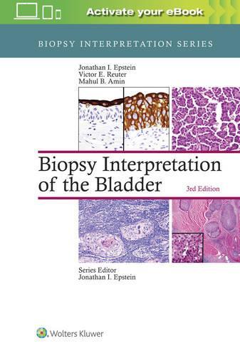 Biopsy Interpretation of the Bladder