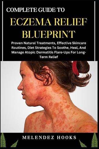 Complete Guide to Eczema Relief Blueprint: Proven Natural Treatments, Effective Skincare Routines, Diet Strategies To Soothe, Heal, And Manage Atopic Dermatitis Flare-Ups For Long-Term Relief