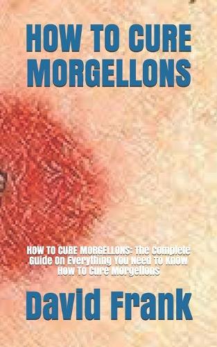 How to Cure Morgellons