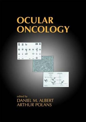 Ocular Oncology