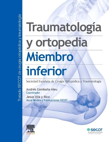Traumatología Y Ortopedia. Miembro Inferior