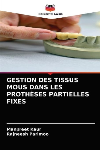 Gestion Des Tissus MOUS Dans Les Prothèses Partielles Fixes