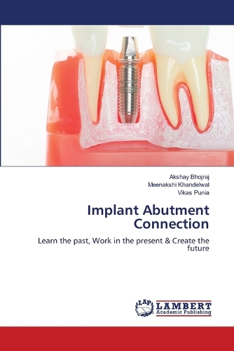 Implant Abutment Connection