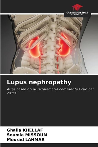 Lupus nephropathy