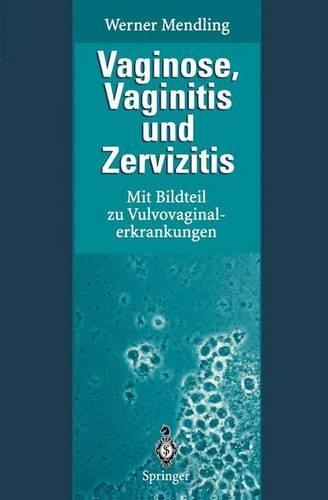 Vaginose, Vaginitis Und Zervizitis: Mit Bildteil Zu Vulvovaginalerkrankungen(German)