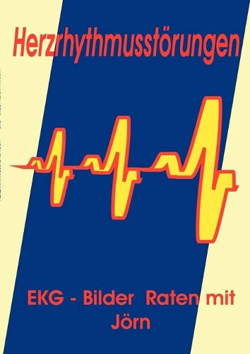 Herzrhythmusstörungen