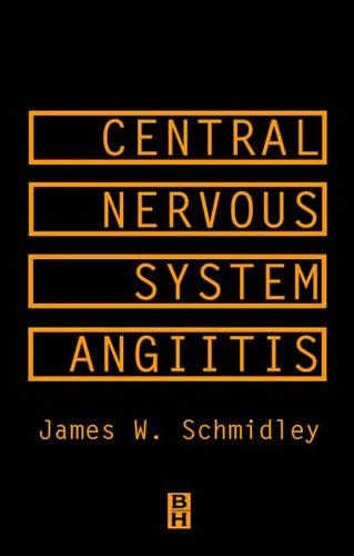 Central Nervous System Angiitis